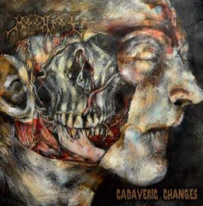 moonfog-cadaveric-changes